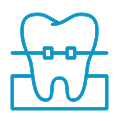 Disegno a linee blu di un dente con apparecchio, mostrato sopra una linea orizzontale, che rappresenta la cura dentale ortodontica.