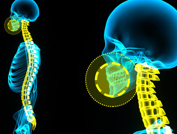 Vista laterale di un sistema scheletrico umano che evidenzia in giallo il cranio, il collo e la mascella, con un focus circolare sull'articolazione temporo-mandibolare in Ortopedia-Coppede-Medical-Hub.